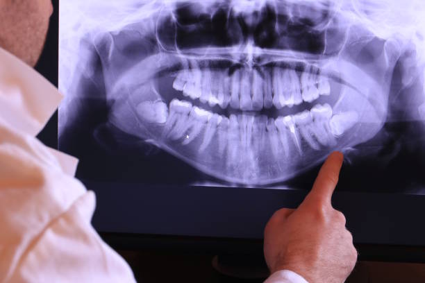 Best Emergency Gum Pain Relief  in Jefferson, OH