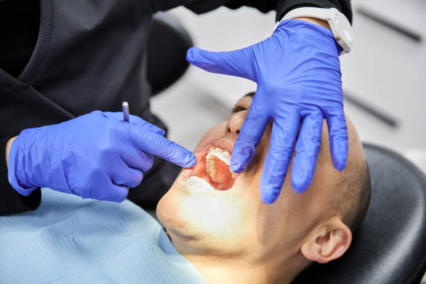 Best Chipped Tooth Repair Near Me  in Jefferson, OH