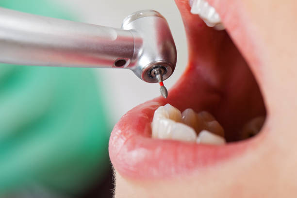 Best Teeth Whitening  in Jefferson, OH